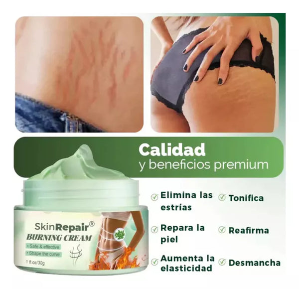 SKIN REPAIR ™| Elimina Tus Estrías em  Semanas.